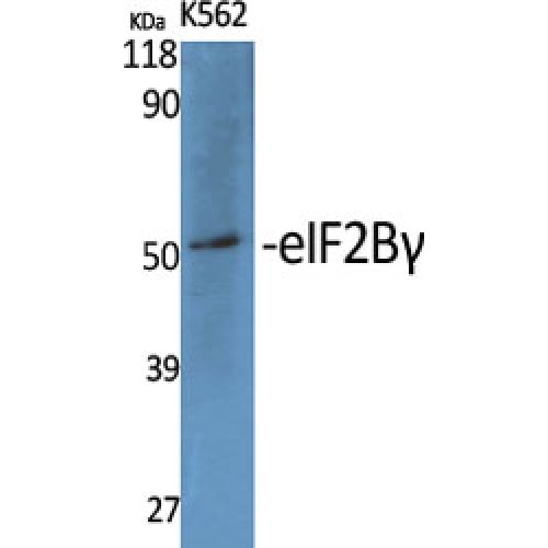 EIF2B3 Antibody - Western blot of eIF2Bgamma antibody