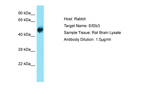 EIF2B3 Antibody -  This image was taken for the unconjugated form of this product. Other forms have not been tested.