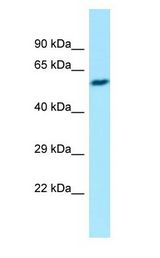 EIF2B3 Antibody - EIF2B3 antibody Western Blot of Fetal Liver.  This image was taken for the unconjugated form of this product. Other forms have not been tested.