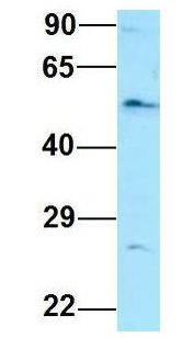 EIF2B3 Antibody - EIF2B3 antibody Western Blot of Human Fetal Lung. Antibody Dilution: 1.0 ug/ml. Antibody dilution: 1 ug/ml.  This image was taken for the unconjugated form of this product. Other forms have not been tested.