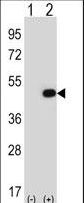 EIF2B3 Antibody - Western blot of EIF2B3 (arrow) using rabbit polyclonal EIF2B3 Antibody. 293 cell lysates (2 ug/lane) either nontransfected (Lane 1) or transiently transfected (Lane 2) with the EIF2B3 gene.