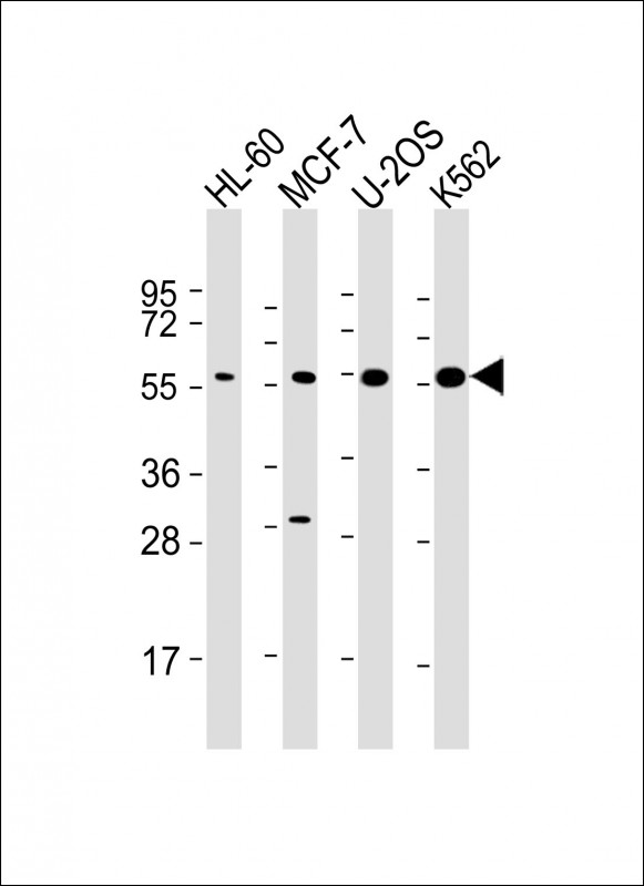 EIF2B3 Antibody - All lanes: Anti-EI2BG Antibody at 1:2000 dilution Lane 1: HL-60 whole cell lysate Lane 2: MCF-7 whole cell lysate Lane 3: U-2OS whole cell lysate Lane 4: K562 whole cell lysate Lysates/proteins at 20 µg per lane. Secondary Goat Anti-mouse IgG, (H+L), Peroxidase conjugated at 1/10000 dilution. Predicted band size: 50 kDa Blocking/Dilution buffer: 5% NFDM/TBST.