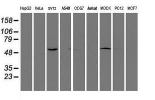 EIF2B3 Antibody - Western blot of extracts (35ug) from 9 different cell lines by using anti-EIF2B3 monoclonal antibody.