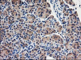 EIF2B3 Antibody - IHC of paraffin-embedded Human pancreas tissue using anti-EIF2B3 mouse monoclonal antibody. (Heat-induced epitope retrieval by 10mM citric buffer, pH6.0, 100C for 10min).