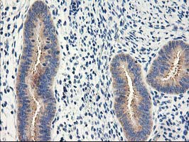 EIF2B3 Antibody - IHC of paraffin-embedded Human endometrium tissue using anti-EIF2B3 mouse monoclonal antibody.
