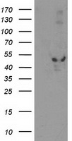 EIF2B3 Antibody - HEK293T cells were transfected with the pCMV6-ENTRY control (Left lane) or pCMV6-ENTRY EIF2B3 (Right lane) cDNA for 48 hrs and lysed. Equivalent amounts of cell lysates (5 ug per lane) were separated by SDS-PAGE and immunoblotted with anti-EIF2B3.