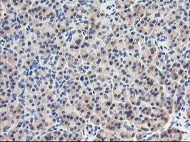 EIF2B3 Antibody - IHC of paraffin-embedded Human pancreas tissue using anti-EIF2B3 mouse monoclonal antibody. (Heat-induced epitope retrieval by 10mM citric buffer, pH6.0, 100C for 10min).