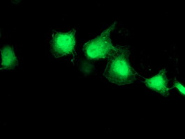EIF2B3 Antibody - Anti-EIF2B3 mouse monoclonal antibody immunofluorescent staining of COS7 cells transiently transfected by pCMV6-ENTRY EIF2B3.