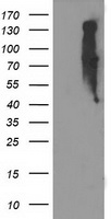 EIF2B3 Antibody - HEK293T cells were transfected with the pCMV6-ENTRY control (Left lane) or pCMV6-ENTRY EIF2B3 (Right lane) cDNA for 48 hrs and lysed. Equivalent amounts of cell lysates (5 ug per lane) were separated by SDS-PAGE and immunoblotted with anti-EIF2B3.