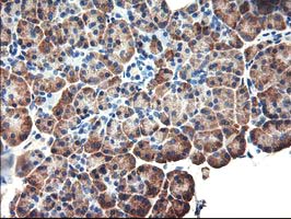 EIF2B3 Antibody - IHC of paraffin-embedded Human pancreas tissue using anti-EIF2B3 mouse monoclonal antibody.