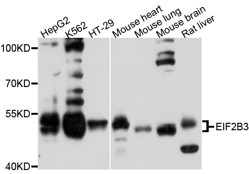 EIF2B3 Antibody - Western blot analysis of extracts of various cell lines, using EIF2B3 antibody at 1:1000 dilution. The secondary antibody used was an HRP Goat Anti-Rabbit IgG (H+L) at 1:10000 dilution. Lysates were loaded 25ug per lane and 3% nonfat dry milk in TBST was used for blocking. An ECL Kit was used for detection and the exposure time was 10s.