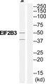 EIF2B3 Antibody - Western blot analysis of extracts from Jurkat cells, using EIF2B3 antibody.