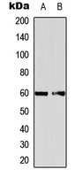 EIF2B4 Antibody - Western blot analysis of EIF2B4 expression in A431 (A); mouse brain (B) whole cell lysates.