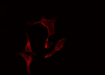 EIF2B4 Antibody - Staining LOVO cells by IF/ICC. The samples were fixed with PFA and permeabilized in 0.1% Triton X-100, then blocked in 10% serum for 45 min at 25°C. The primary antibody was diluted at 1:200 and incubated with the sample for 1 hour at 37°C. An Alexa Fluor 594 conjugated goat anti-rabbit IgG (H+L) antibody, diluted at 1/600, was used as secondary antibody.