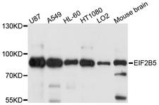 EIF2B5 Antibody - Western blot analysis of extracts of various cell lines, using EIF2B5 antibody at 1:1000 dilution. The secondary antibody used was an HRP Goat Anti-Rabbit IgG (H+L) at 1:10000 dilution. Lysates were loaded 25ug per lane and 3% nonfat dry milk in TBST was used for blocking. An ECL Kit was used for detection and the exposure time was 10s.