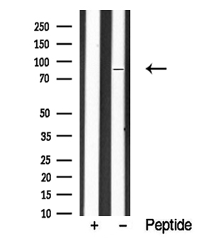 EIF2B5 Antibody - Western blot analysis of eIF2B in lysates of HeLa cells using eIF2B antibody.