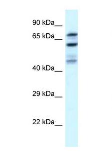 EIF2B5 Antibody - EIF2B5 antibody Western blot of U937 Cell lysate. Antibody concentration 1 ug/ml.  This image was taken for the unconjugated form of this product. Other forms have not been tested.