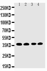 EIF2S1 Antibody - WB of EIF2S1 antibody. Lane 1: COLO320 Cell Lysate. Lane 2: CEM Cell Lysate. Lane 3: RAJI Cell Lysate. Lane 4: HT1080 Cell Lysate.