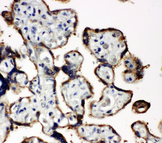 EIF2S1 Antibody - EIF2S1 antibody. IHC(P): Human Placenta Tissue.