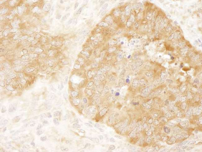 EIF2S1 Antibody - Detection of Mouse eIF2alpha/EIF2S1 by Immunohistochemistry. Sample: FFPE section of mouse teratoma. Antibody: Affinity purified rabbit anti-eIF2alpha/EIF2S1 used at a dilution of 1:100. Epitope Retrieval Buffer-High pH (IHC-101J) was substituted for Epitope Retrieval Buffer-Reduced pH.