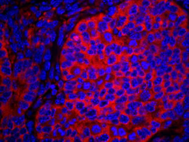 EIF2S1 Antibody - Detection of Mouse eIF2alpha/EIF2S1 by Immunohistochemistry. Sample: FFPE section of mouse teratoma. Antibody: Affinity purified rabbit anti-eIF2alpha/EIF2S1 used at a dilution of 1:100. Detection: Red-fluorescent goat anti-rabbit IgG highly cross-adsorbed Antibody used at a dilution of 1:100.