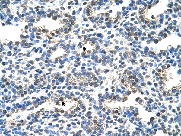 EIF2S1 Antibody - EIF2S1 antibody ARP40508_T100-NP_004085-EIF2S1(eukaryotic translation initiation factor 2, subunit 1 alpha, 35kDa) Antibody was used in IHC to stain formalin-fixed, paraffin-embedded human lung.  This image was taken for the unconjugated form of this product. Other forms have not been tested.