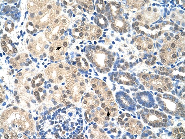 EIF2S1 Antibody - EIF2S1 antibody ARP40508_T100-NP_004085-EIF2S1(eukaryotic translation initiation factor 2, subunit 1 alpha, 35kDa) Antibody was used in IHC to stain formalin-fixed, paraffin-embedded human kidney.  This image was taken for the unconjugated form of this product. Other forms have not been tested.