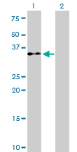EIF2S1 Antibody - Western Blot analysis of EIF2S1 expression in transfected 293T cell line by EIF2S1 monoclonal antibody (M01), clone 3H12-C11.Lane 1: EIF2S1 transfected lysate(36.1 KDa).Lane 2: Non-transfected lysate.