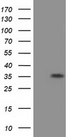 EIF2S1 Antibody - HEK293T cells were transfected with the pCMV6-ENTRY control (Left lane) or pCMV6-ENTRY EIF2S1 (Right lane) cDNA for 48 hrs and lysed. Equivalent amounts of cell lysates (5 ug per lane) were separated by SDS-PAGE and immunoblotted with anti-EIF2S1.