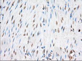 EIF2S1 Antibody - Immunohistochemical staining of paraffin-embedded Human colon tissue using anti-EIF2S1 mouse monoclonal antibody. (Dilution 1:50).