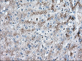 EIF2S1 Antibody - Immunohistochemical staining of paraffin-embedded Human liver tissue using anti-EIF2S1 mouse monoclonal antibody. (Dilution 1:50).
