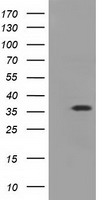 EIF2S1 Antibody - HEK293T cells were transfected with the pCMV6-ENTRY control (Left lane) or pCMV6-ENTRY EIF2S1 (Right lane) cDNA for 48 hrs and lysed. Equivalent amounts of cell lysates (5 ug per lane) were separated by SDS-PAGE and immunoblotted with anti-EIF2S1.