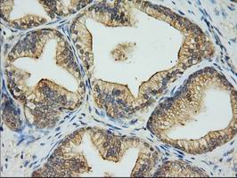 EIF2S1 Antibody - Immunohistochemical staining of paraffin-embedded Human prostate tissue using anti-EIF2S1 mouse monoclonal antibody.