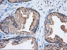 EIF2S1 Antibody - Immunohistochemical staining of paraffin-embedded Human prostate tissue using anti-EIF2S1 mouse monoclonal antibody. (Dilution 1:50).