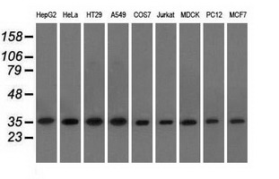 EIF2S1 Antibody - Western blot of extracts (35 ug) from 9 different cell lines by using anti-EIF2S1 monoclonal antibody.