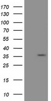 EIF2S1 Antibody - HEK293T cells were transfected with the pCMV6-ENTRY control (Left lane) or pCMV6-ENTRY EIF2S1 (Right lane) cDNA for 48 hrs and lysed. Equivalent amounts of cell lysates (5 ug per lane) were separated by SDS-PAGE and immunoblotted with anti-EIF2S1.