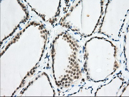 EIF2S1 Antibody - IHC of paraffin-embedded Human thyroid tissue using anti-EIF2S1 mouse monoclonal antibody. (Dilution 1:50).