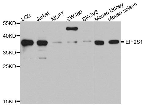 EIF2S1 Antibody - Western blot analysis of extracts of various cell lines, using EIF2S1 antibody at 1:1000 dilution. The secondary antibody used was an HRP Goat Anti-Rabbit IgG (H+L) at 1:10000 dilution. Lysates were loaded 25ug per lane and 3% nonfat dry milk in TBST was used for blocking. An ECL Kit was used for detection and the exposure time was 90s.