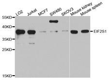 EIF2S1 Antibody - Western blot analysis of extracts of various cell lines, using EIF2S1 antibody at 1:1000 dilution. The secondary antibody used was an HRP Goat Anti-Rabbit IgG (H+L) at 1:10000 dilution. Lysates were loaded 25ug per lane and 3% nonfat dry milk in TBST was used for blocking. An ECL Kit was used for detection and the exposure time was 90s.