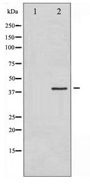EIF2S1 Antibody - Western blot of eIF2 alpha expression in IFN- alpha treated K562 whole cell lysates,The lane on the left is treated with the antigen-specific peptide.