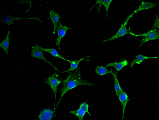 EIF2S1 Antibody - Immunofluorescent analysis of MCF-7 cells using EIF2S1 Antibody at a dilution of 1:100 and Alexa Fluor 488-congugated AffiniPure Goat Anti-Rabbit IgG(H+L)