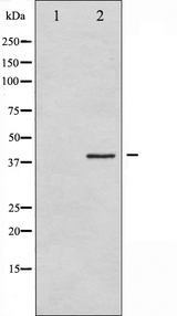 EIF2S1 Antibody - Western blot analysis of eIF2 alpha expression in IFN-a treated K562 whole cells lysates. The lane on the left is treated with the antigen-specific peptide.