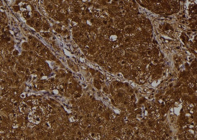 EIF2S1 Antibody - 1:100 staining human liver tissue by IHC-P. The sample was formaldehyde fixed and a heat mediated antigen retrieval step in citrate buffer was performed. The sample was then blocked and incubated with the antibody for 1.5 hours at 22°C. An HRP conjugated goat anti-rabbit antibody was used as the secondary.