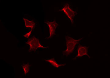 EIF2S1 Antibody - Staining K562 cells by IF/ICC. The samples were fixed with PFA and permeabilized in 0.1% Triton X-100, then blocked in 10% serum for 45 min at 25°C. The primary antibody was diluted at 1:200 and incubated with the sample for 1 hour at 37°C. An Alexa Fluor 594 conjugated goat anti-rabbit IgG (H+L) Ab, diluted at 1/600, was used as the secondary antibody.