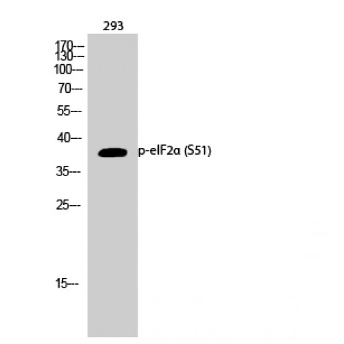 EIF2S1 Antibody - Western blot of Phospho-eIF2alpha (S51) antibody