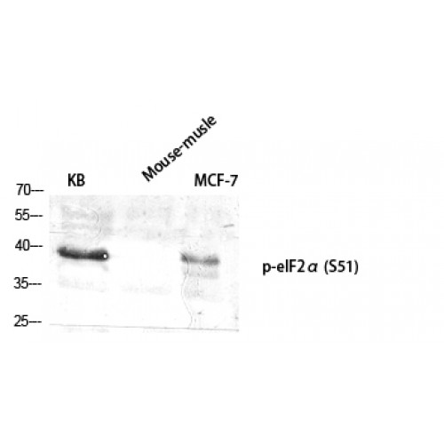 EIF2S1 Antibody - Western blot of Phospho-eIF2alpha (S51) antibody