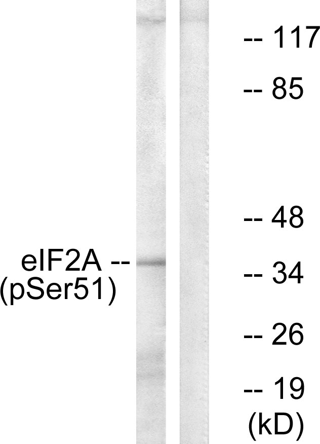 EIF2S1 Antibody - Western blot analysis of lysates from K562 cells treated with IFN-alpha 1000U/ml 18h, using eIF2 alpha (Phospho-Ser51) Antibody. The lane on the right is blocked with the phospho peptide.