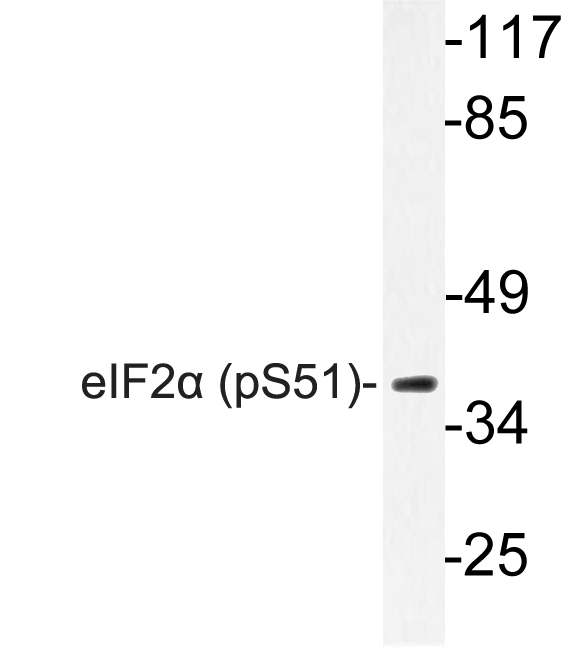 EIF2S1 Antibody - Western blot of p-eIF2 (S51) pAb in extracts from Jurkat insulin cells.