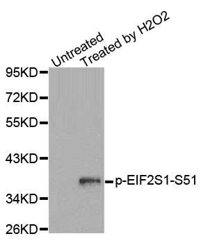 EIF2S1 Antibody - Western blot analysis of extracts from Jurkat cells.