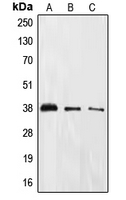 EIF2S1 Antibody - Western blot analysis of EIF2S1 (pS51) expression in HeLa (A); PC12 (B); A431 (C) whole cell lysates.